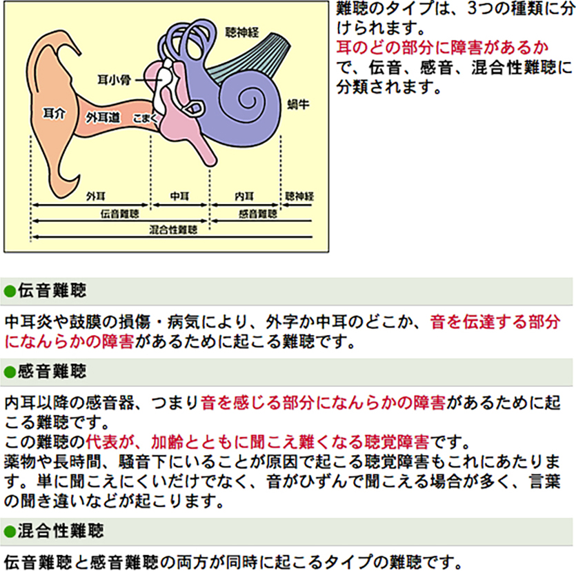 聞こえについて